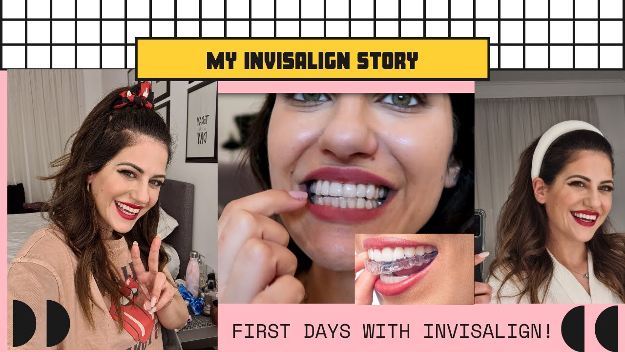 Story Time: Έβαλα Invisalign μασελάκια! Οι 3 πρώτες ημέρες
