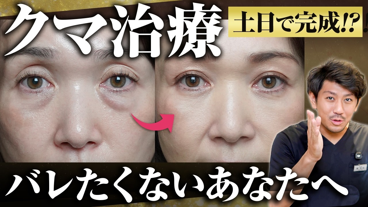 【1週間経過あり】なぜこんなに綺麗？クマ治療のダウンタイムを最短で終わらせる方法をお伝えします。