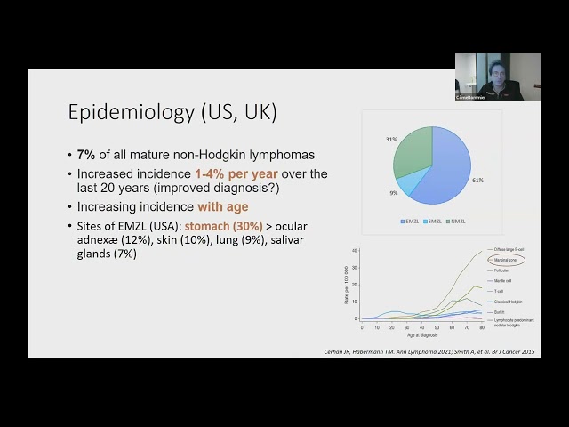 Webinaire  AIH : Lymphome de la zone marginale