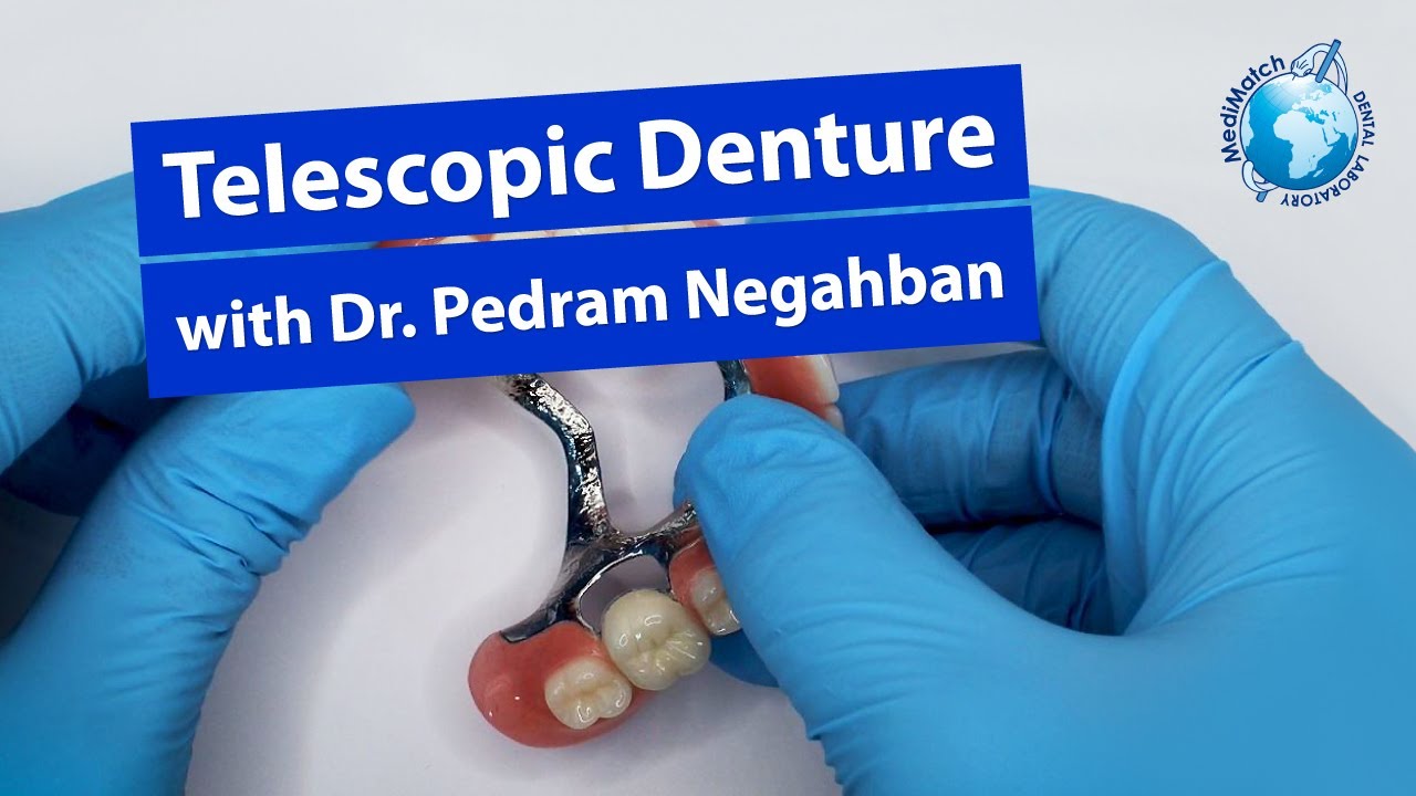 PROTOCOL ★ Telescopic Denture Workshop