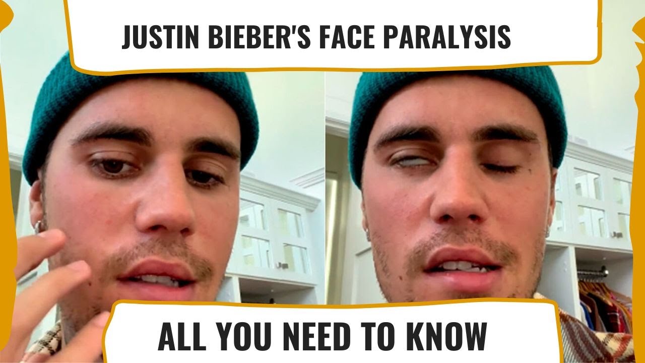 Justin Bieber's Ramsay Hunt Syndrome: What You Should Know About The ...