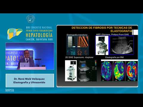 Vídeo: Evaluación De La Respuesta De Inmunoterapia Con Elastografía De Resonancia Magnética (ERM) En CHC Avanzado