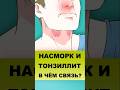 НАСМОРК, ГАСТРИТ, РЕФЛЮКС? Виноват тонзиллит! #насморк #тонзиллит
