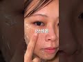肌に溜まった角栓洗浄方法カビの○し方をご紹介！#自分磨き #毛穴ケア #角栓 #クレンジング #美意識 pr