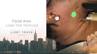 Laser hair removal facial area | Light Touch Laser Spa NYC