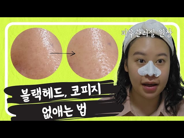블랙헤드부터 남은 코피지까지 싹 다 없애는 방법