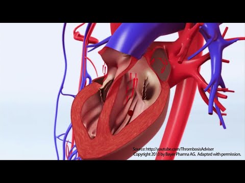 Vídeo: Per què warfarina per a la fibril·lació auricular?