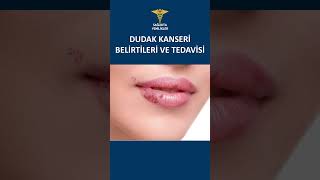 DUDAK KANSERİ BELİRTİLERİ VE TEDAVİSİ