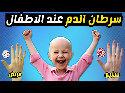 ما هي اعراض سرطان الدم عند الاطفال ؟