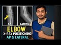 “Elbow X-ray Positioning: AP &amp; Lateral View Explained Step-by-Step”|RADIOLOGY TECH 