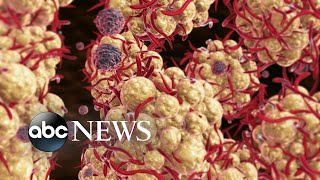 White House monkeypox response team holds briefing | ABCNL