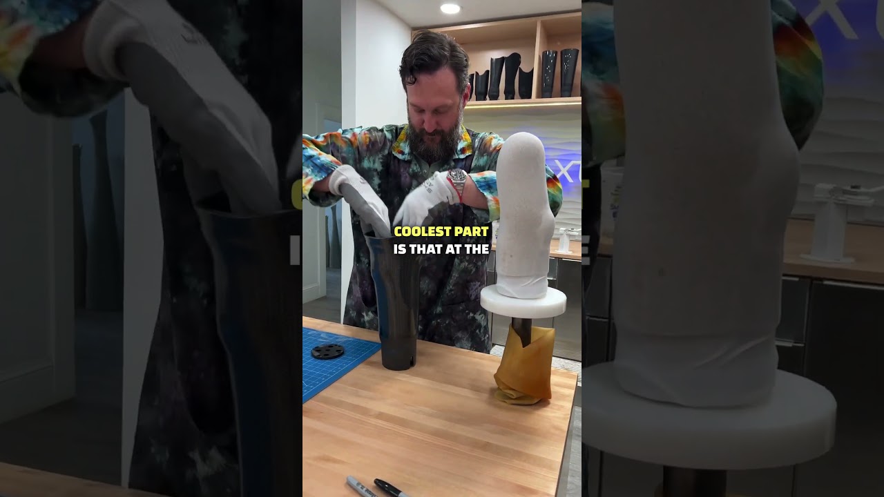 Делаю ПЕРВЫЕ шаги после ампутации (последней!)! 🎉