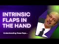 Intrinsic flaps in the hand ideal flaps for small defects in the hand and fingers