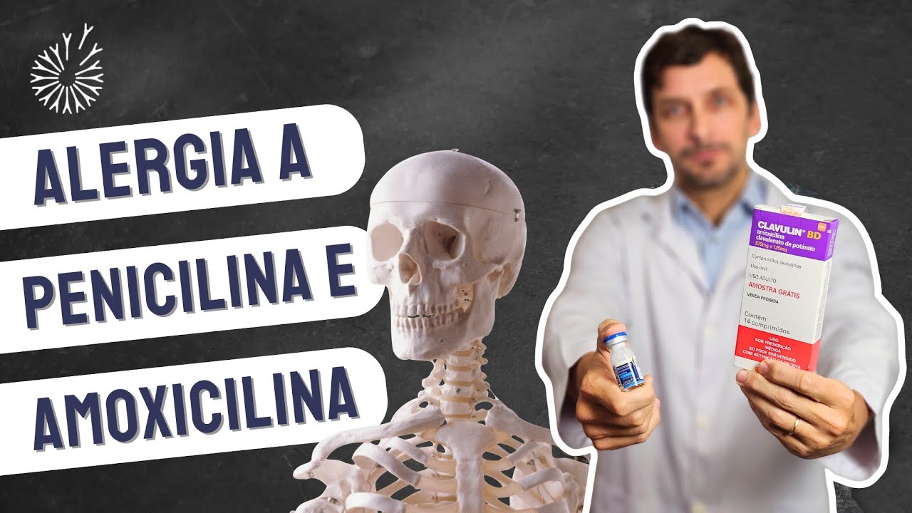 ALERGIA A PENICILINA E AMOXICILINA l #amoxicillin #penicilina # ...