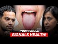 Your Tongue Can Reveal What S Wrong With Your Body Dimple Jangda Explains Raj Shamani Clips
