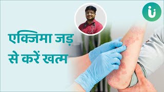 आपकी खुजली कहीं एक्जिमा तो नहीं? जान लें एक्जिमा के लक्षण, कारण और सही इलाज - Eczema in Hindi screenshot 5