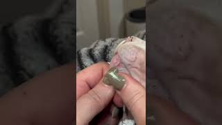 Goosie's greatest hits #sphynx  #sphynxcat_insta #blackheadremoval #cat