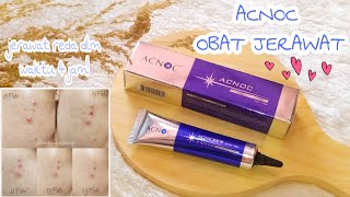 Review Jujur Obat Jerawat Acnoc Spot Gel. Jerawat Sembuh Dalam Waktu 4 Jam Aja