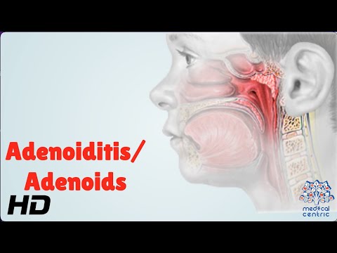 Video: Wat zijn je adenoïden?