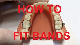 How to fit bands on teeth
