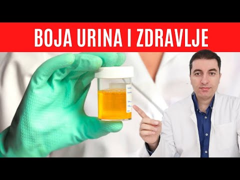 Što boja URINA govori o Vašem zdravlju?