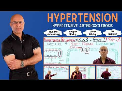 Hypertension | Hypertensive Arteriosclerosis