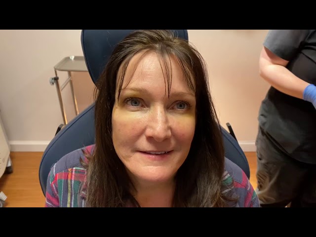 Dallas Facelift & Fat Transfer One Week Out