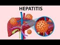 Hepatitis B