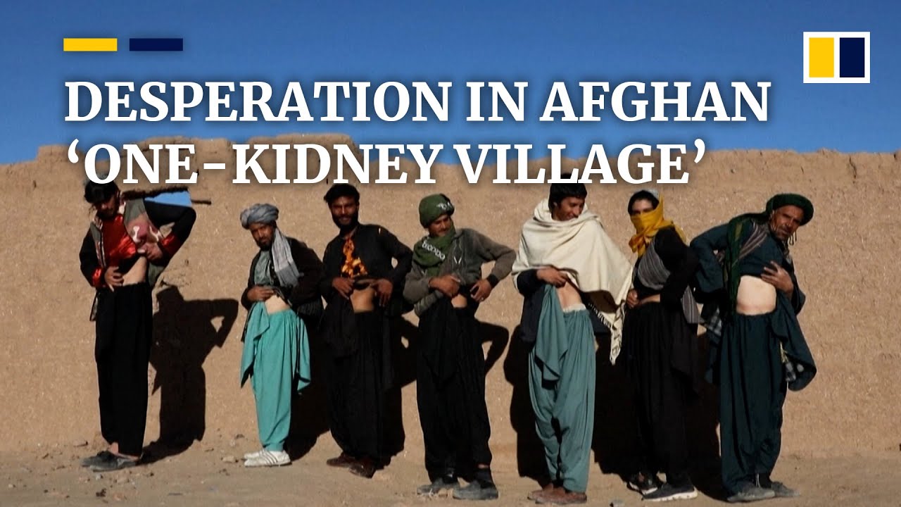 People in Afghanistan’s ‘one-kidney village’ sell their organs to try and feed their families