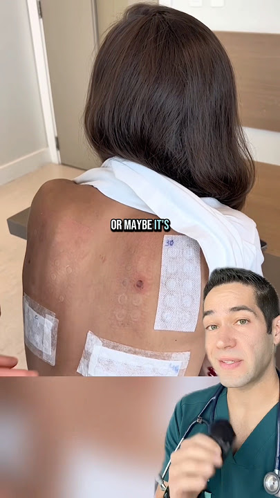 Doctor Explains: allergy test