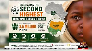 Preventable Blindness: Nigeria Strengthens Fight Against Trachoma in Rural Communities