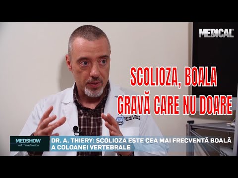 Video: Corset Pentru Scolioză - Indicații, Argumente Pro și Contra, Tipuri