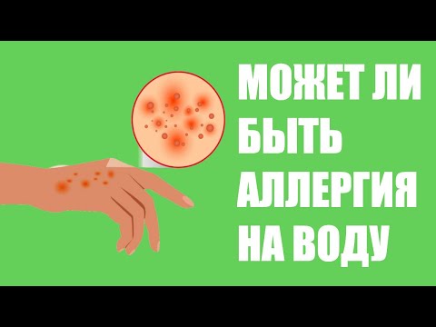 Может ли быть аллергия на воду