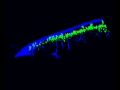 You have NOT SEEN this: Here’s how AIDS virus attacks the body! (VIDEO)