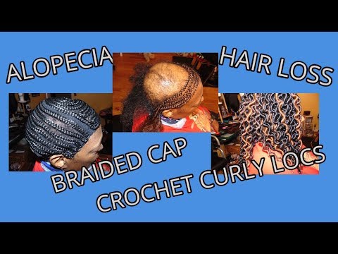 alopecia/hair-loss-protective-hairstyle-with-up-to-date-braided-cap-for-women