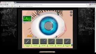 Lets Play: Eye Surgery screenshot 2