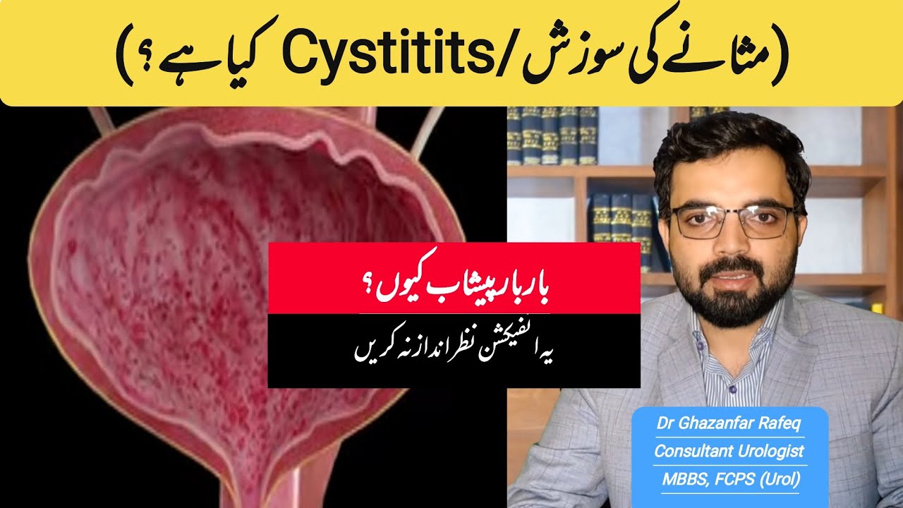 Cystitis (Urinary Infection) | Causes, Symptoms & Treatment | Dr ...