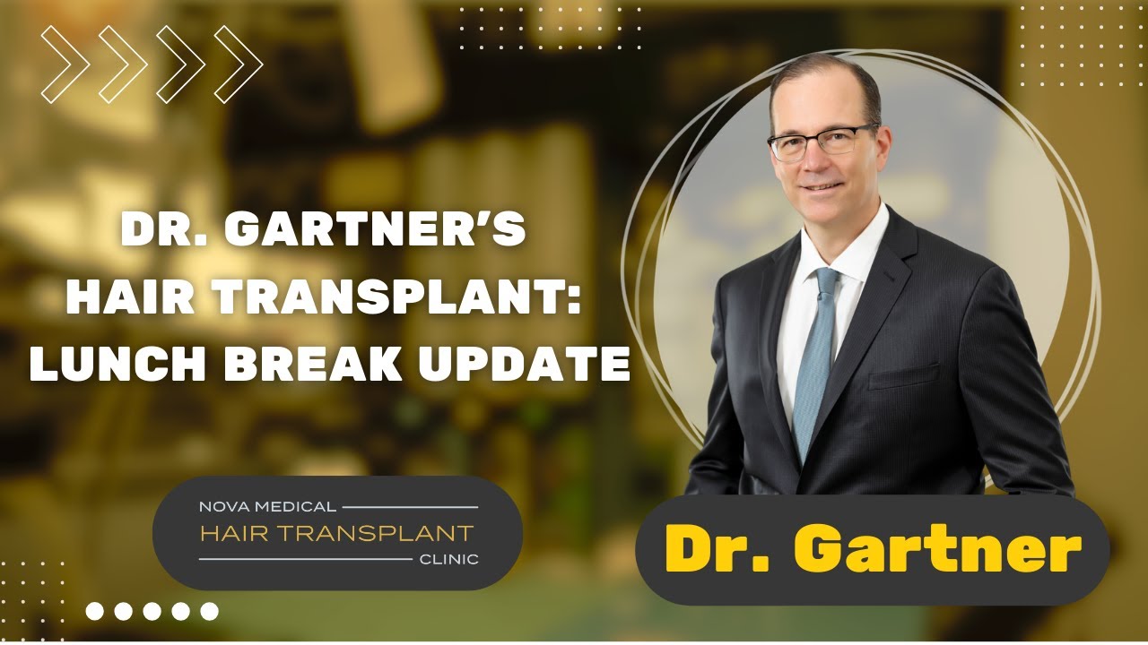Dr. Gartner's Hair Transplant Lunch Break Update Nova Medical Hair