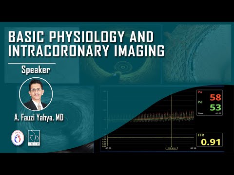 Video: Apakah itu gemcitabine intravesical?