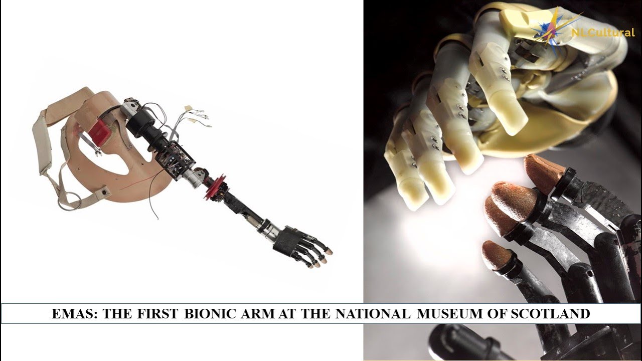 EMAS: The first bionic arm at the National Museum of Scotland - YouTube