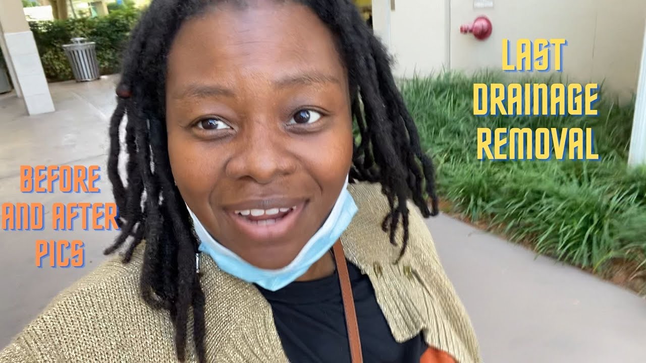 My Tummy Tuck Surgery Drainage removal / Before and After pics YouTube