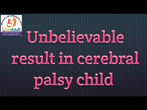 Successful treatment of cp child .achieve the self walk within 2 months