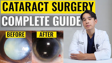 Staaroperatie in 2025: de alles-in-één PATIËNTgids