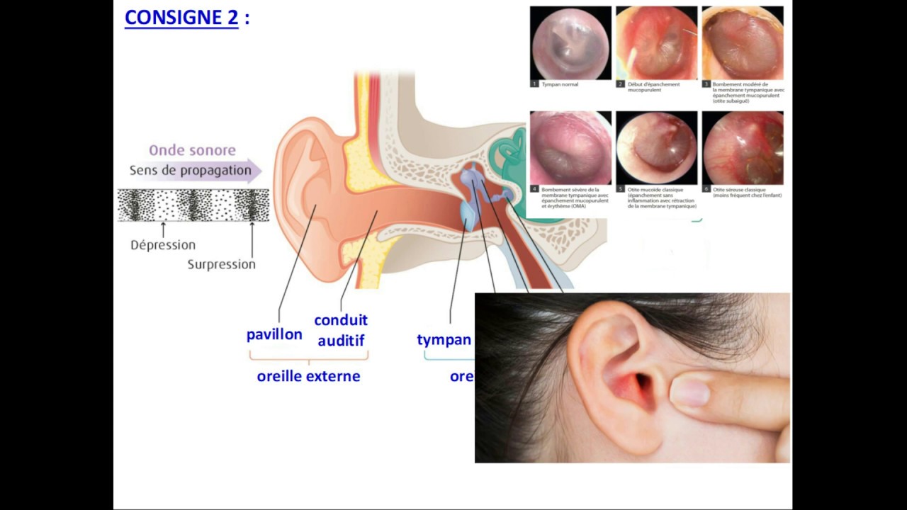 ESSVT 1ère transmission et perception des sons par l'oreille (3/4