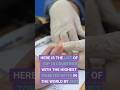 How fast is Diabetes growing around the world #youtubeshorts #Shorts #diabetes
