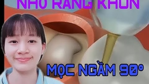 Quá trình Nhổ Răng Khôn mọc ngầm