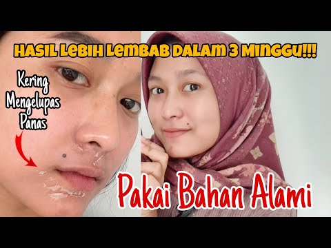 CARA MENGATASI WAJAH KERING DAN MENGELUPAS SECARA ALAMI MENGGUNAKAN