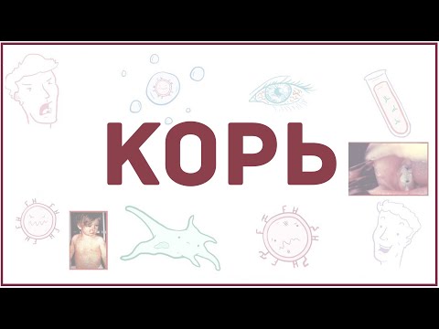 Видео: Как распознать корь: 7 шагов (с картинками)