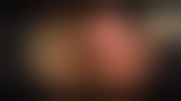 Single port VATS : Pulmonary wedge resection with 15mm trocar. (Tower craine technique)