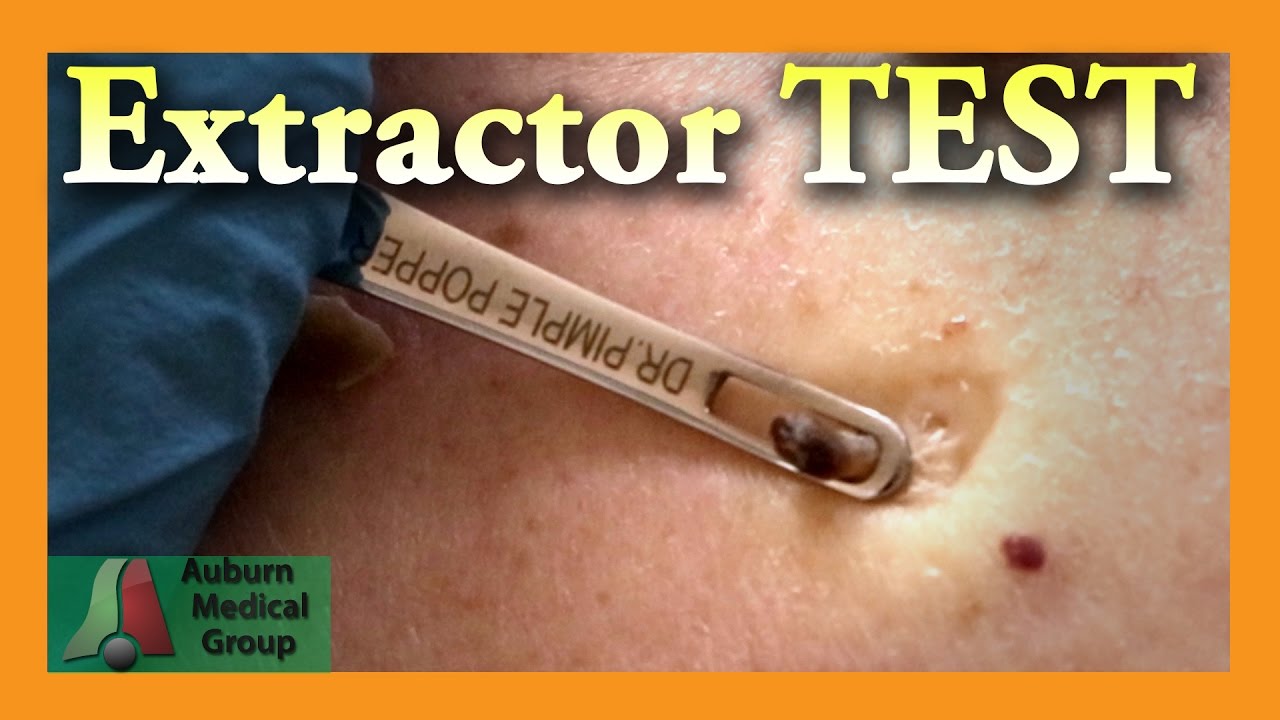 medical grade pimple extractor medical grade pimple extractor